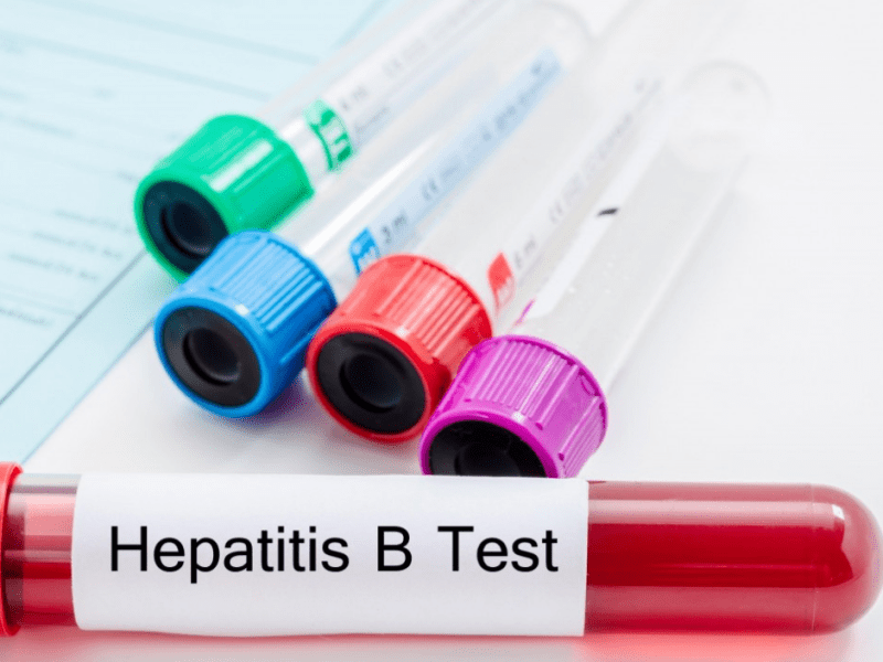 Hepatitis B In The Workplace: What The Management Should&nbsp;Know